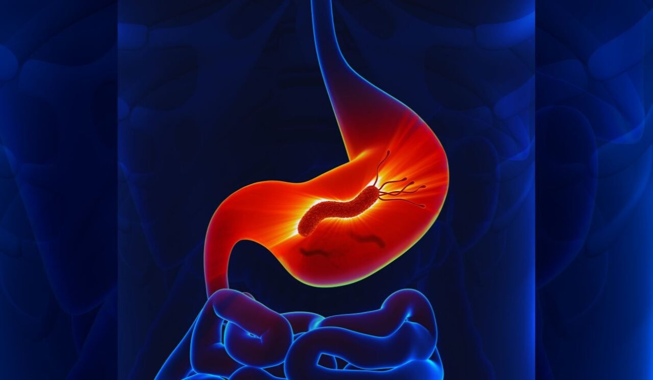 Helicobacter pylori: Unmasking a Hidden Threat to Nigeria and Africa’s Gut Health Helicobacter pylori: Unmasking a Hidden Threat to Nigeria and Africa’s Gut Health
