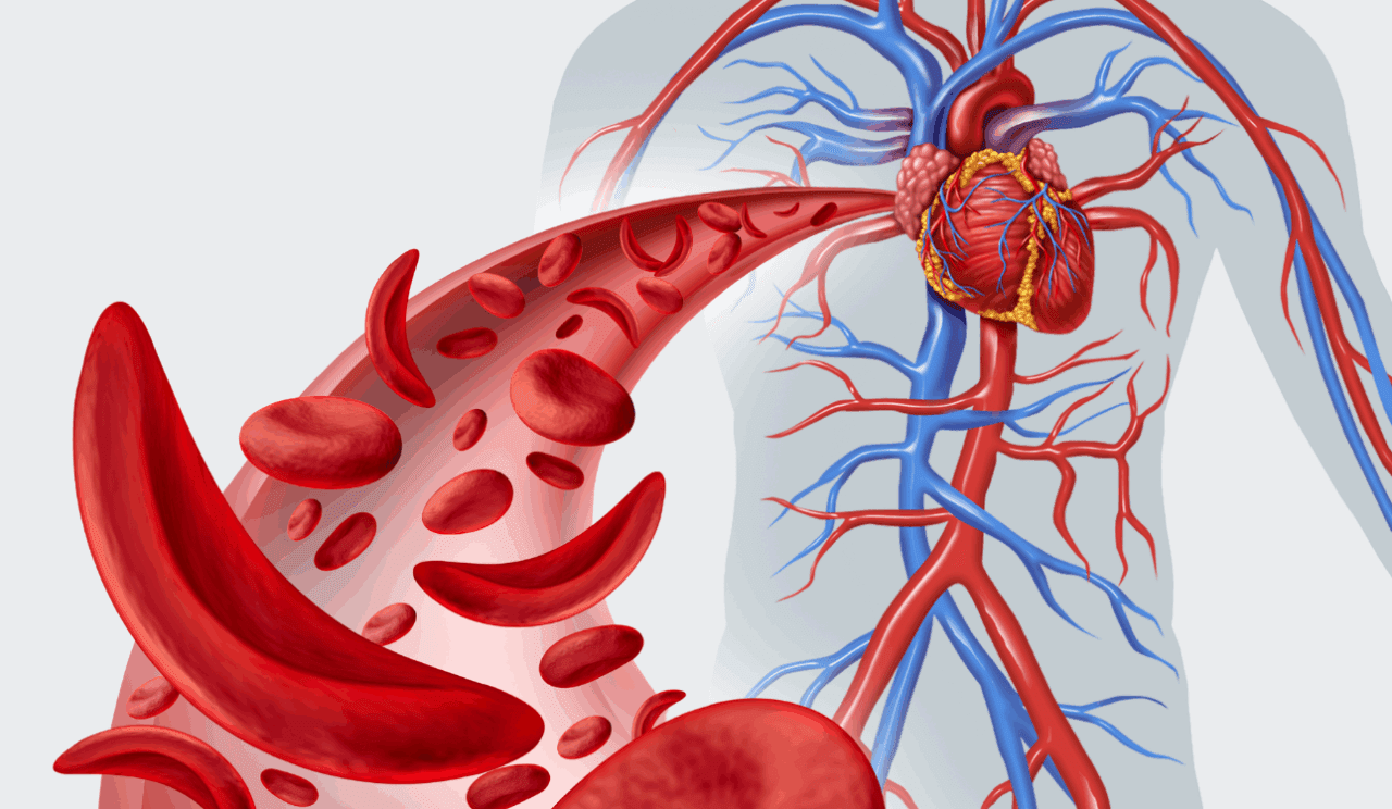 UK Approves New Combination Therapy for Blood Cancer Patients UK Approves New Combination Therapy for Blood Cancer Patients