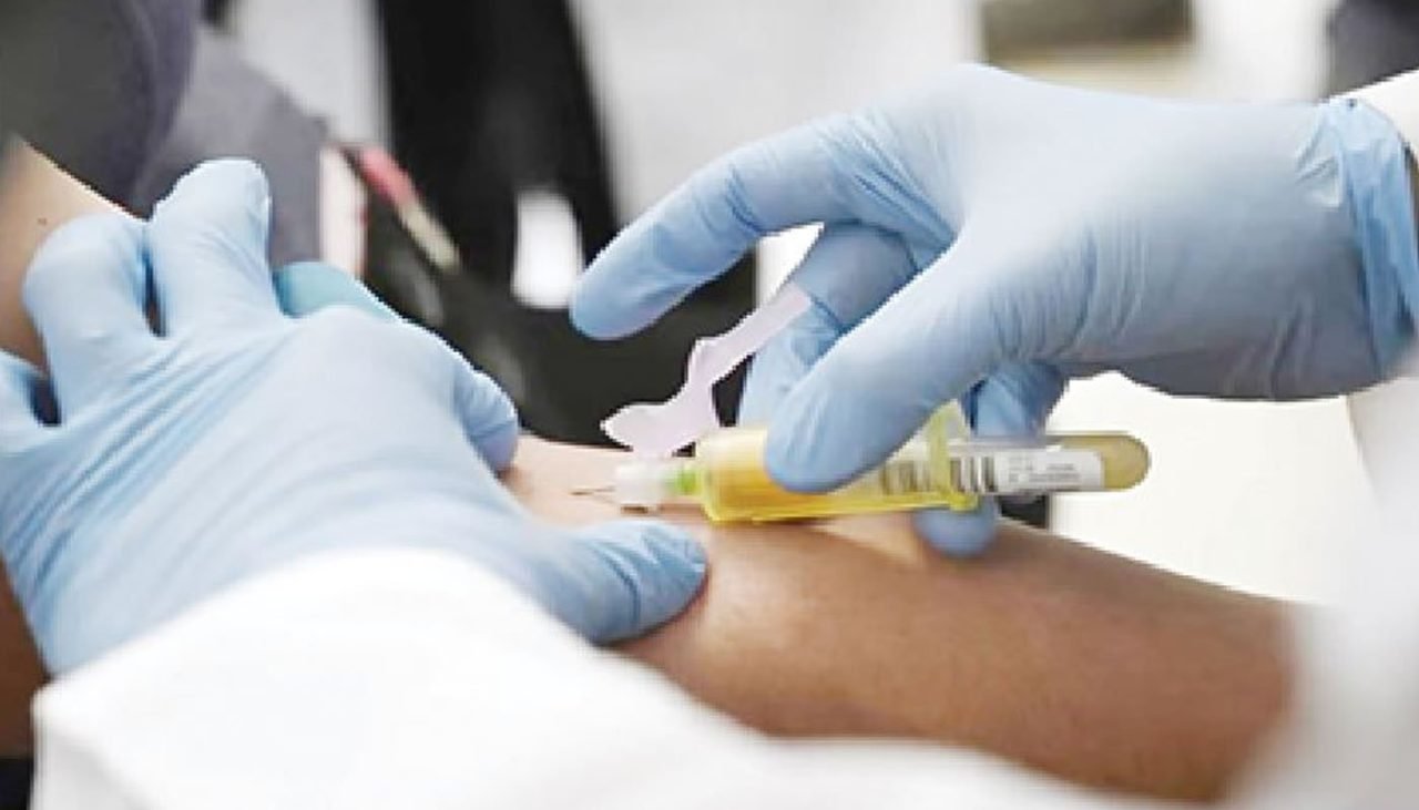 Hiv-Screening